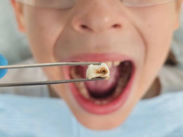Best Emergency Dental Surgery in St Rose, LA