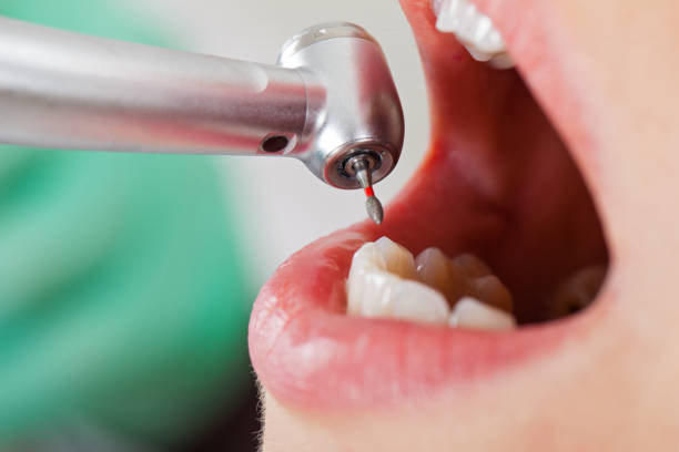 Best Walk-In Emergency Dentist in St Rose, LA